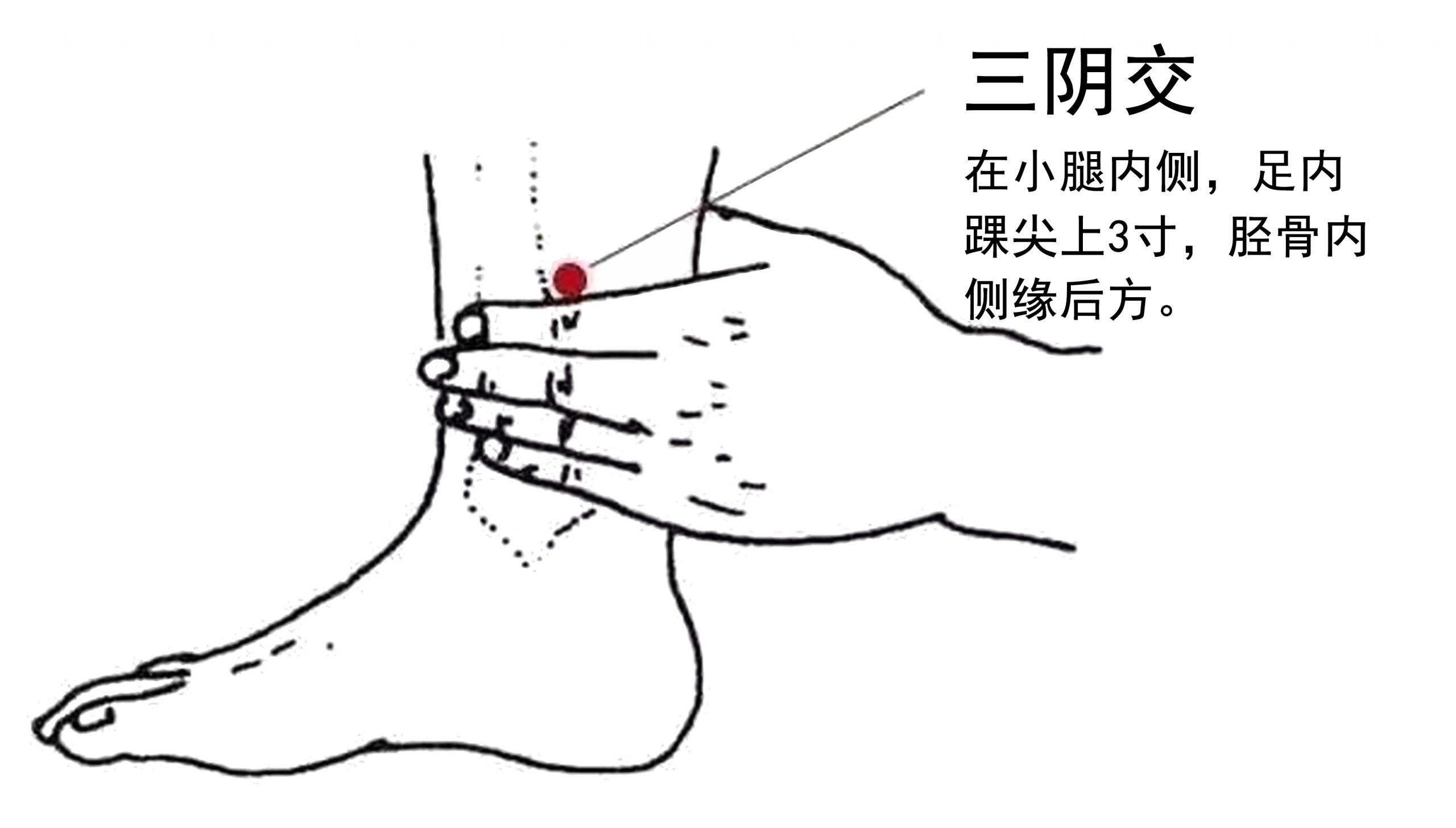 三阴交