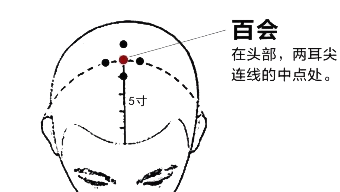 百会穴